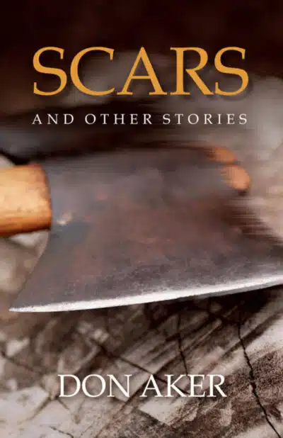 Scars and Other Stories